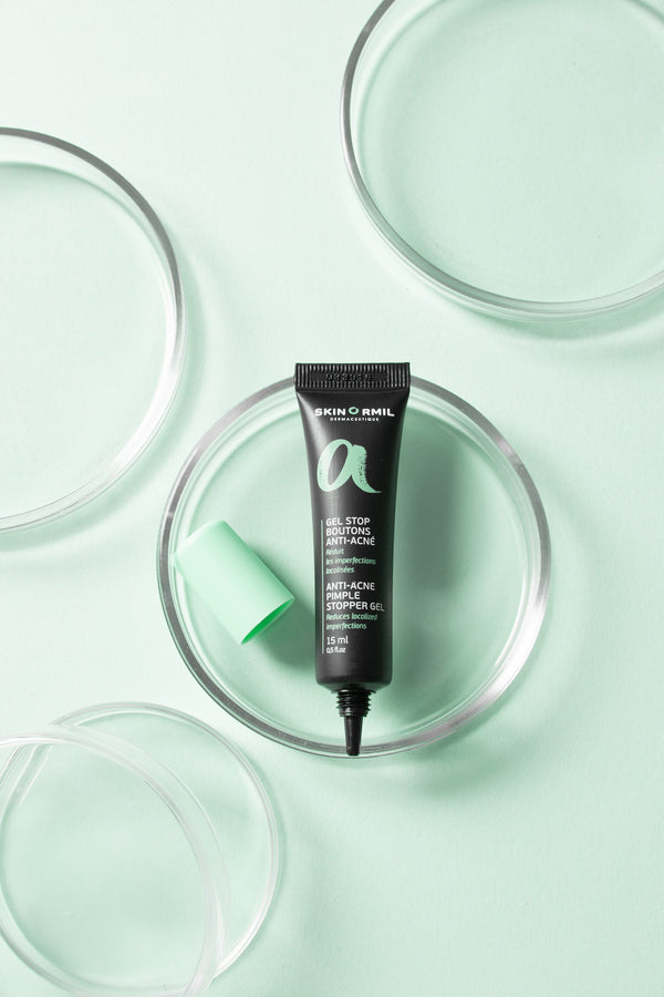 Anti-Acne pimple stopper gel